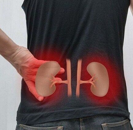 Low's pain can happen with pyelonephritis