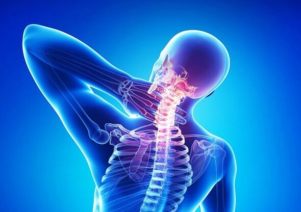Cervical column with osteochondrosis