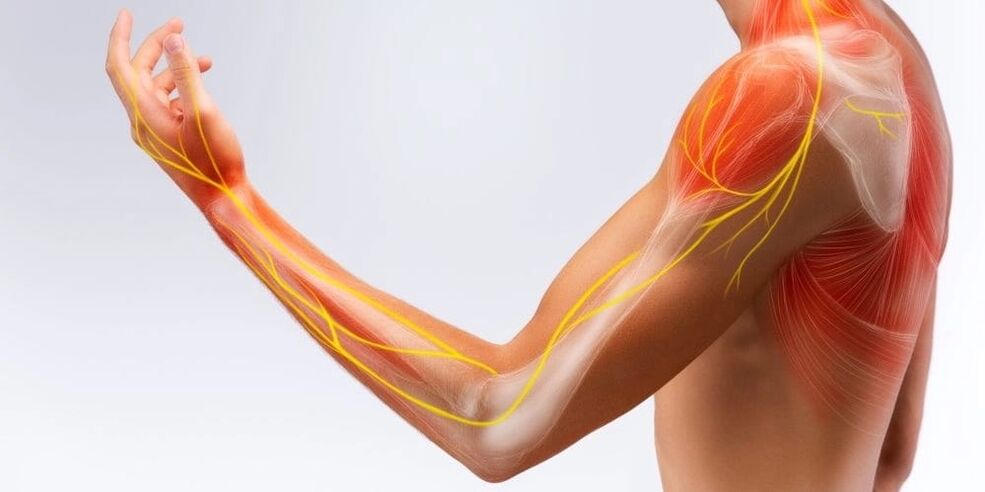 Pain and numbness in the fingers indicate damage to the ligaments due to stenosing ligamentitis.