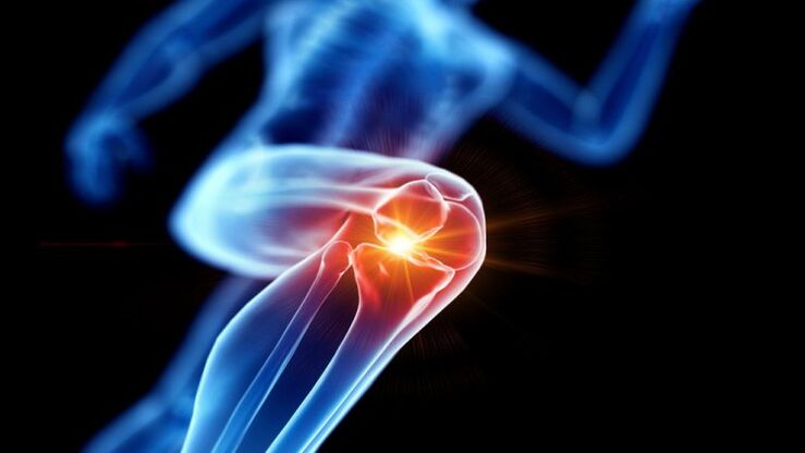 osteoarthritis of the knee joint